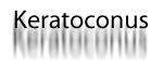 simple, huh? keratoconus simple, huh?